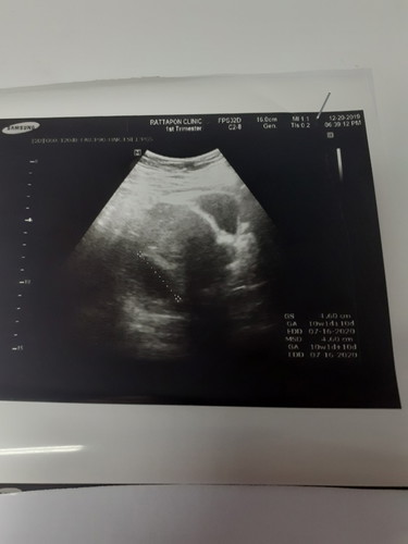 ขอสอบถามคะ