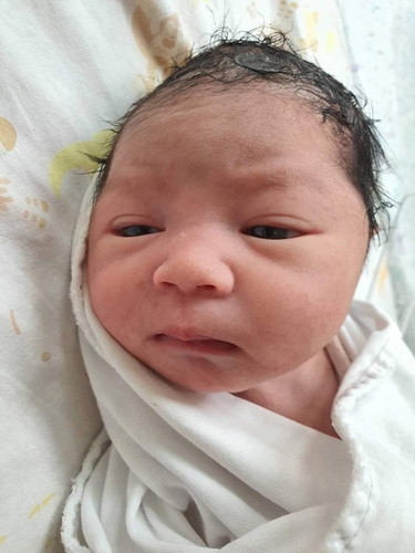 แตกแล้วจ้า 38+5 ตั้งใจคลอดเองแต่สุดท้าย ได้ผ่าคลอด บล็อกหลัง+ดมยาสลบ