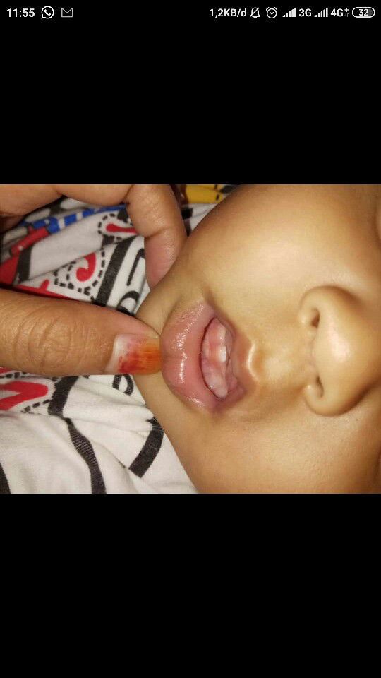 4bulan tumbuh gigi??