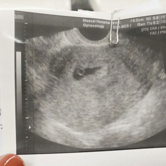 ไปซาวมาคุณหมอหาน้องไม่เจอ