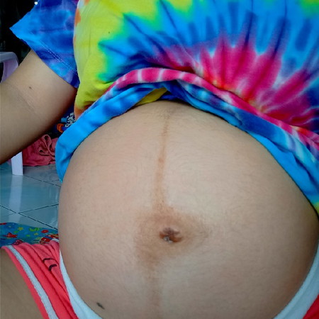 29+5W ท้องแบบนี้ ญรึชค่ะ