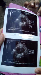31week ❤️?