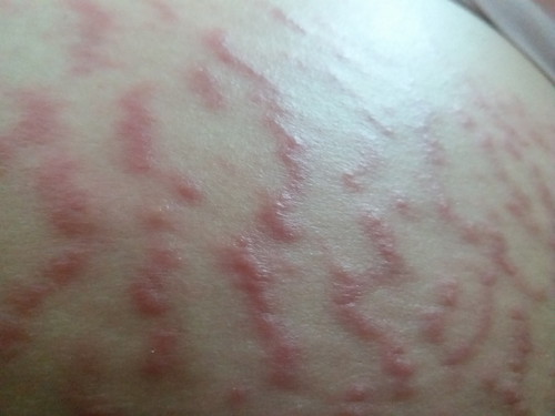 ใครลายแบบนี้บ้าง