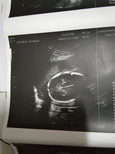 6เดือน8วันแล้วค่ะ