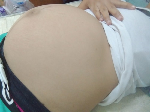 ปกติไม่ค่ะ