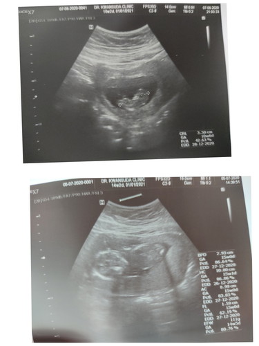 ลูกใครเคยกลับตัวแบบนี้บ้างคะ