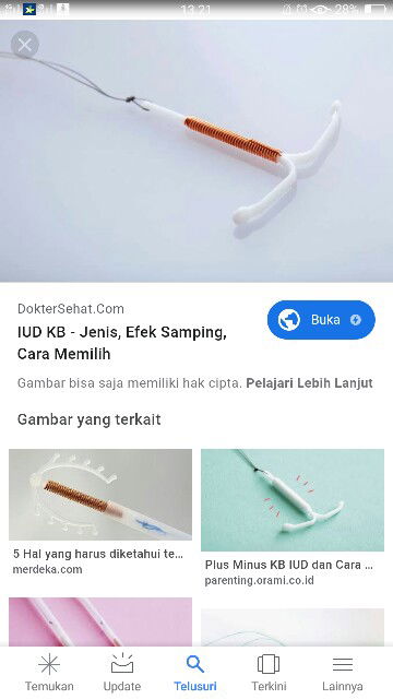 kb iud