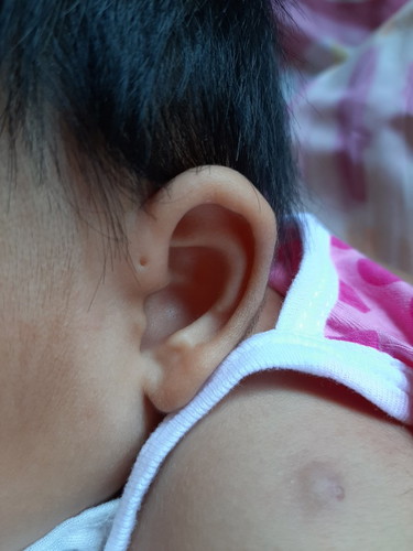 สอบถามแม่ๆจ้า