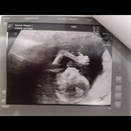 Ultra Sound ครั้งแรก 13W เมื่อกลางเดือน พ.ย.62