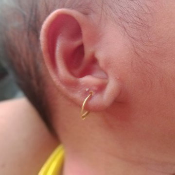 belekan bayi