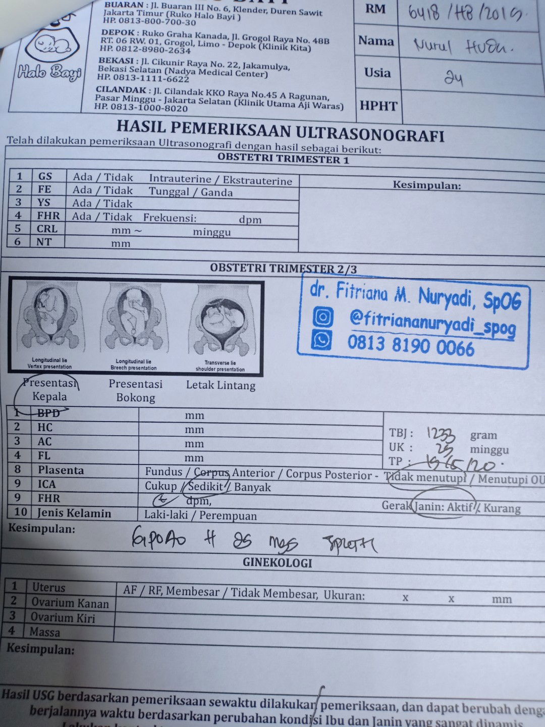 air ketuban sedikit dan bbj bayik kurang