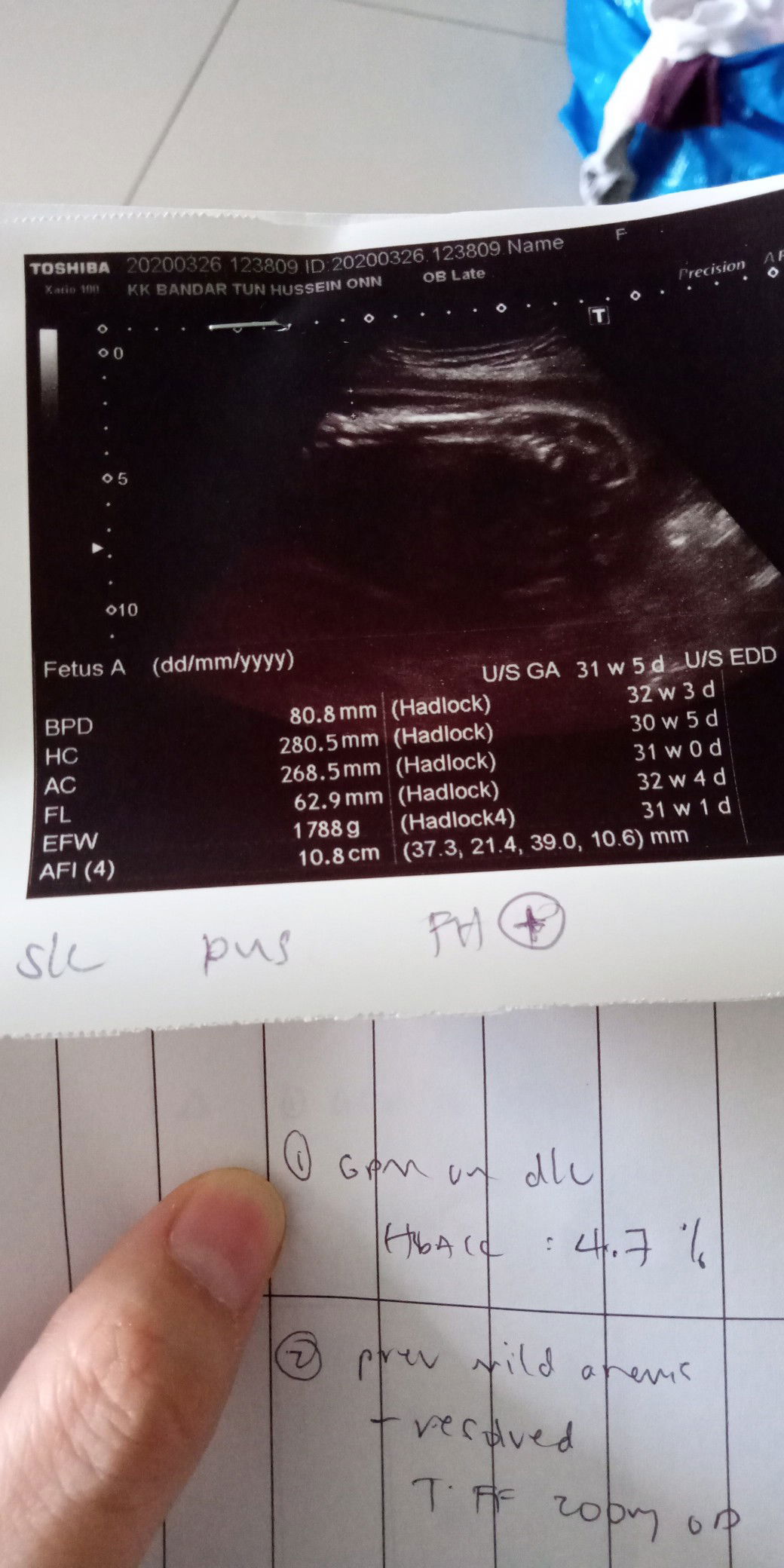 air ketuban makin berkurang