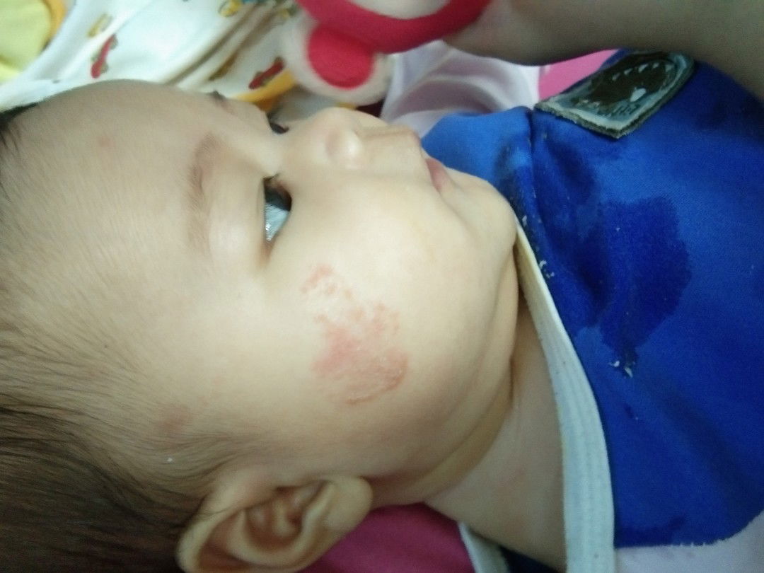 ใช้อะไรทาแล้วหายบ้างค่ะ