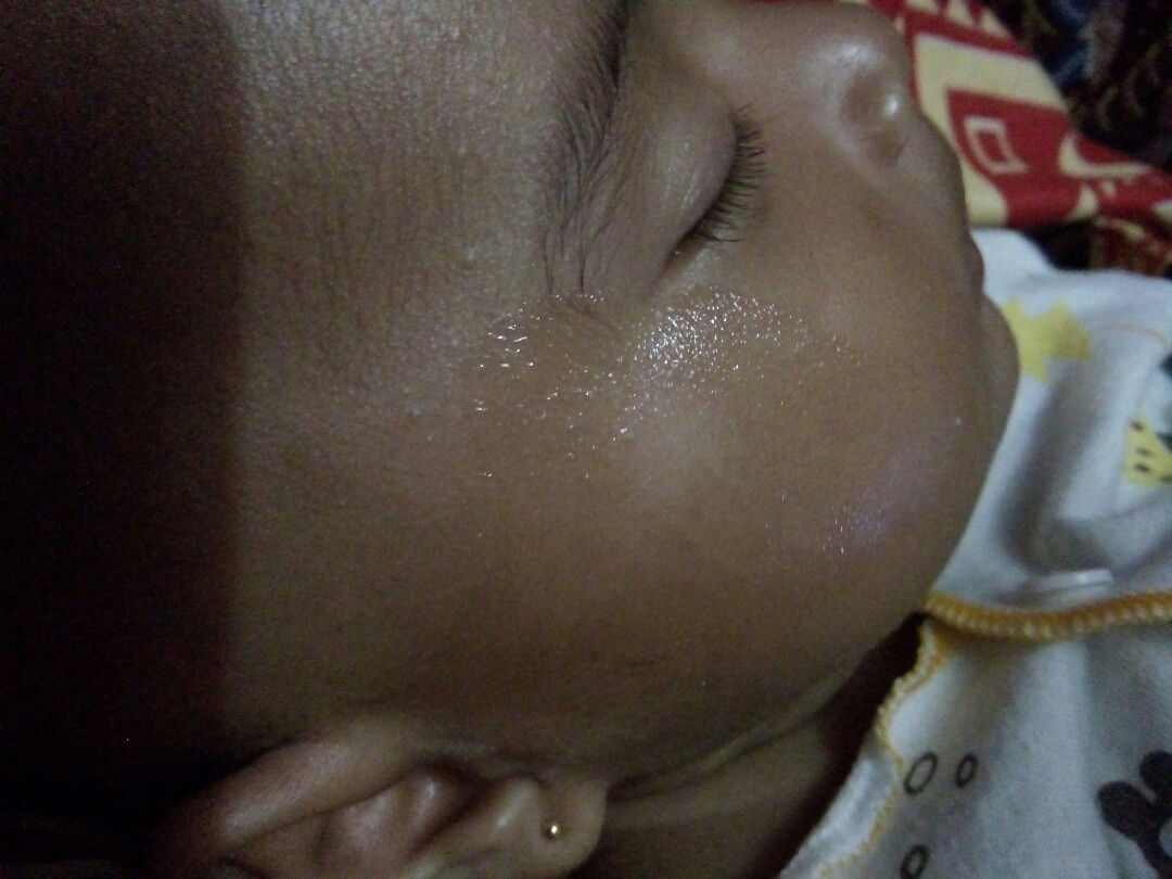 lingkaran putih di wajah