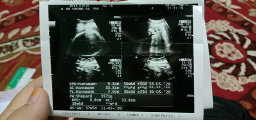 terlewatkah kelahiran anak saya?