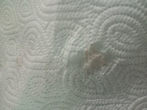 ฉี่สีแดงขุ่น