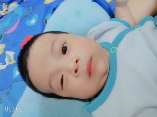 ตาสองข้างไม่เท่ากัน