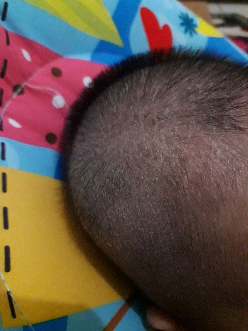 Kulit kepala anak lanang