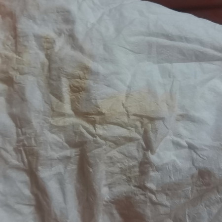 มันคือเลือดหรือเปล่าคะ