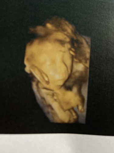 หัวใจเด็กอยู่ด้านขวา