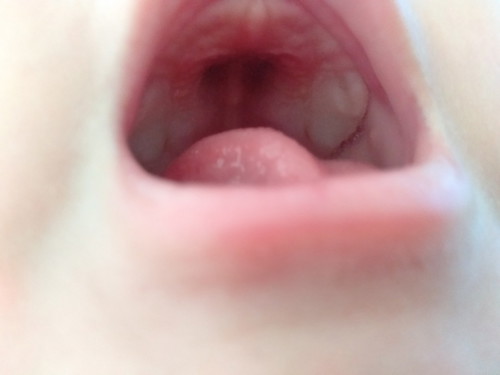 คราบนมหรืออะไรค่ะ