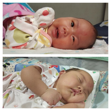 แบ่งปัน ประสบการณ์ ลูกตัวเหลืองเพราะนมแม่ ค่ะ