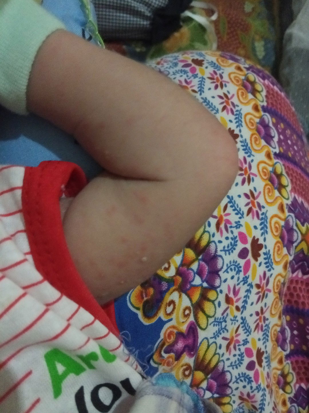 bintik merah dan ada yang bernanah