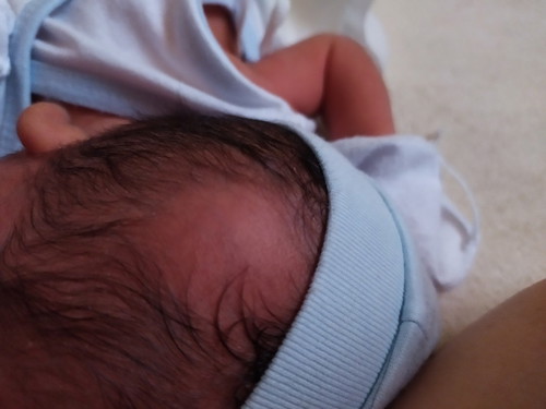 part sa ulo ni baby na walang buhok