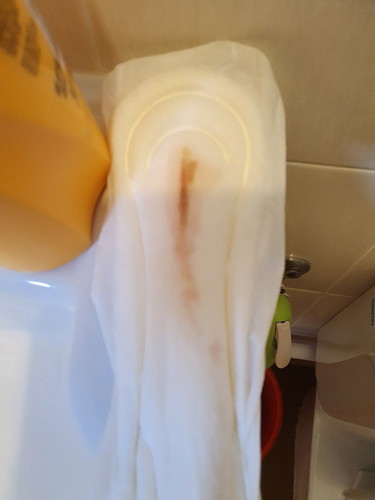 37 weeks - 1st timer