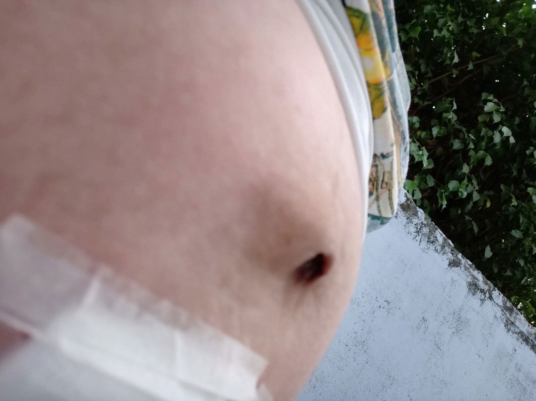 normal lang ba to mga momshie?