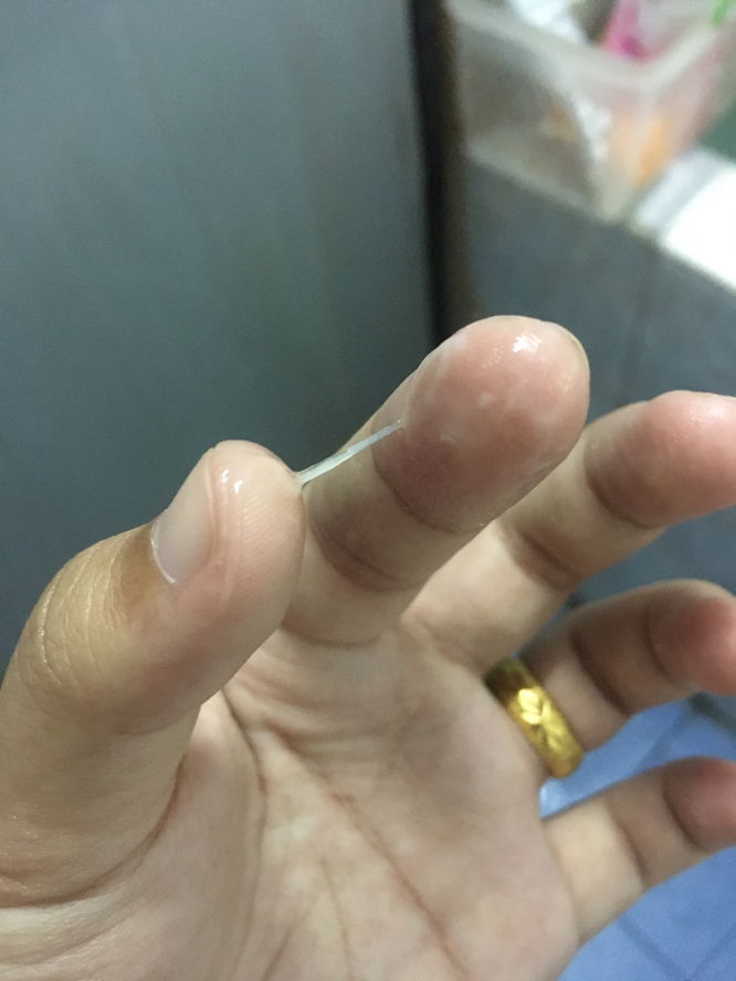 แบบนี้มูกใสรึป่าวคะแม่ๆ