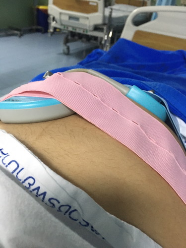 แม่ๆคนไหนเคยท้องเสียแล้วเป็นแบบนี้บ้างคะ