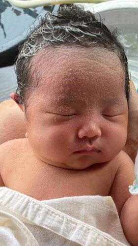 แม่ท่านไหนมีวิธีเช็ดคราบกาวออกจากใบหน้าลูกบ้าง