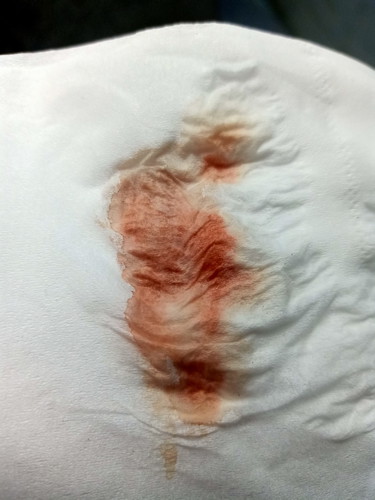 อันตรายไหมคะ