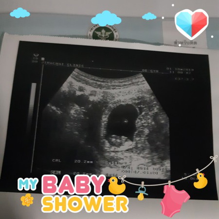 เจ้าตัวเล็ก 8 วีคแล้ววววครับบบบ