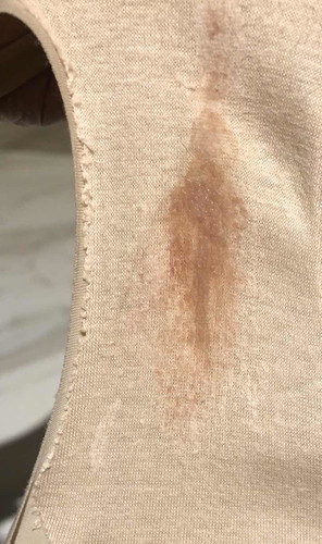 ตกขาวสีแบบนี้ผิดปกติไหมค่ะ