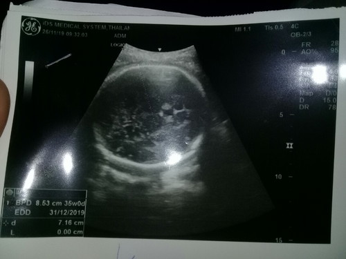 ดูน้ำหนักเด็กตรงไหนค่ะ