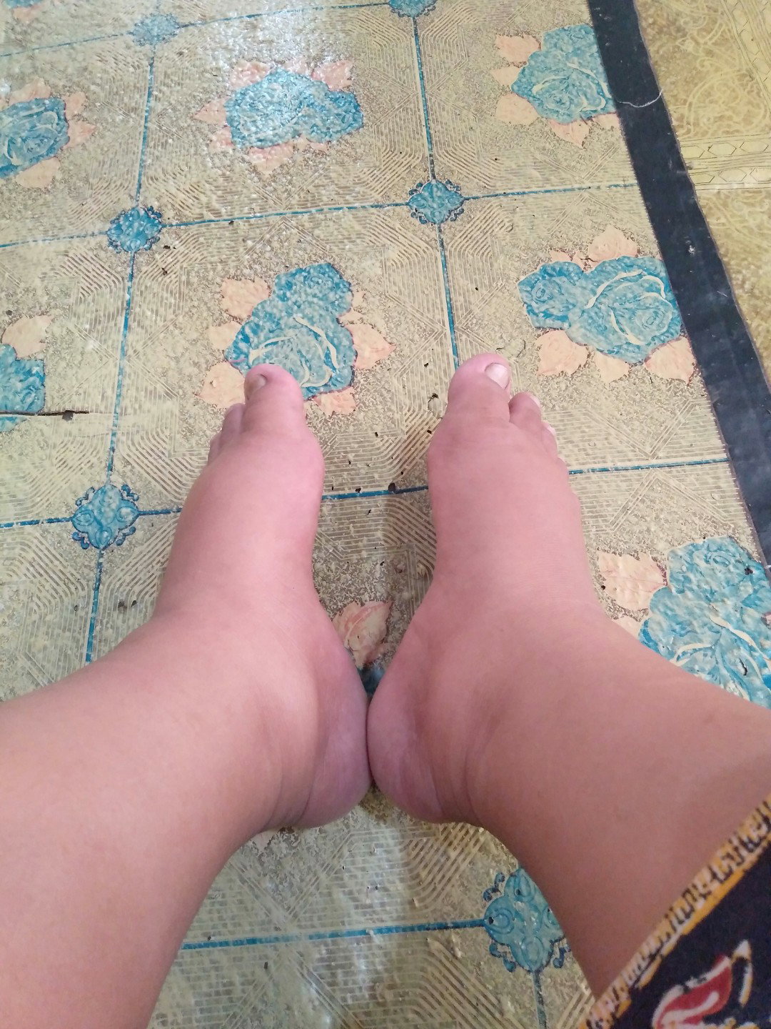 37week4d