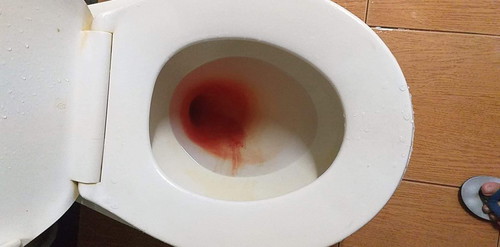 ตกบันได