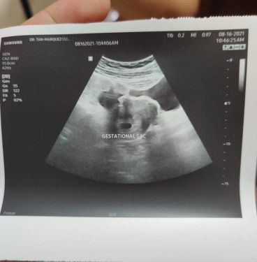 Kathleen Balila profile icon