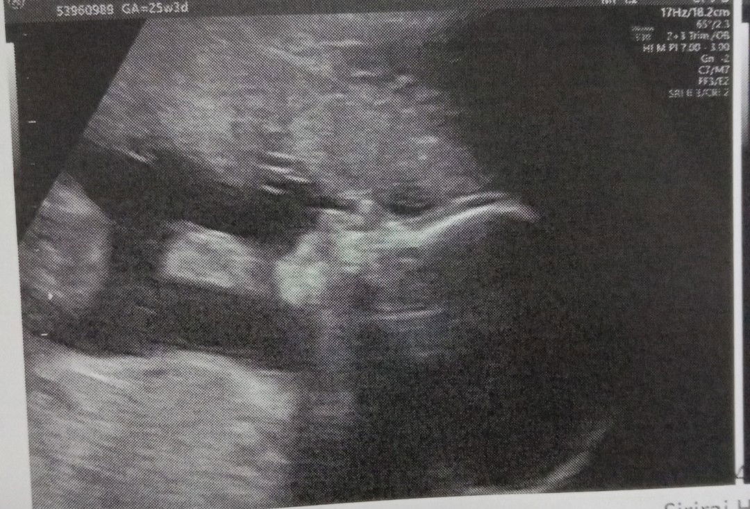 ณัฐพร นที profile icon