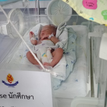 ครรภ์เป็นพิษคันรุนแรง