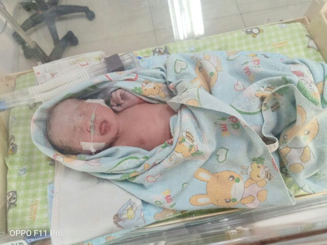 akhir nya harus cesar