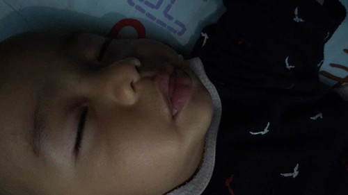 น้องพอล อายุ 8 เดือน 2 วันหัวร้อนมาก นอนเหงื่อออกที่หัวเปียกชุ่มที่นอนผิดปกติไหมค่ะ