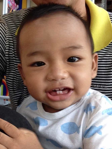 ลูกชอบวิ่งชนวัตถุตรงหน้าล้ม เค้ามีปัญหาสายตาป่าว น้อง 1 ขวบ 2 เดือน