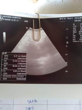 37w+5d ยังไม่เห็นเลยหญิงหรือชายจะแอบแม่ถึงไหน