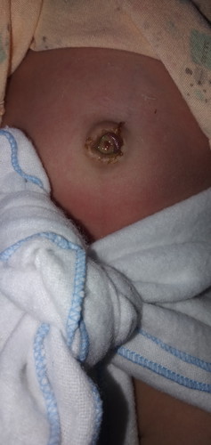 สดือหลุด