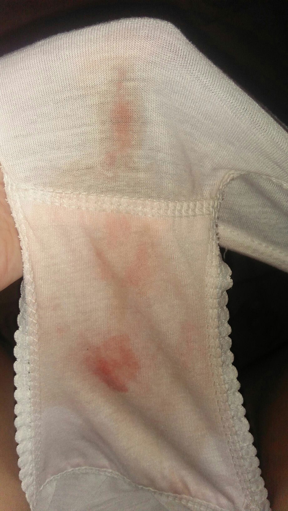 perlu segera ke fasilitas kesehatan gak ya bund