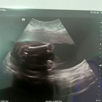 เพศอะไรคะ