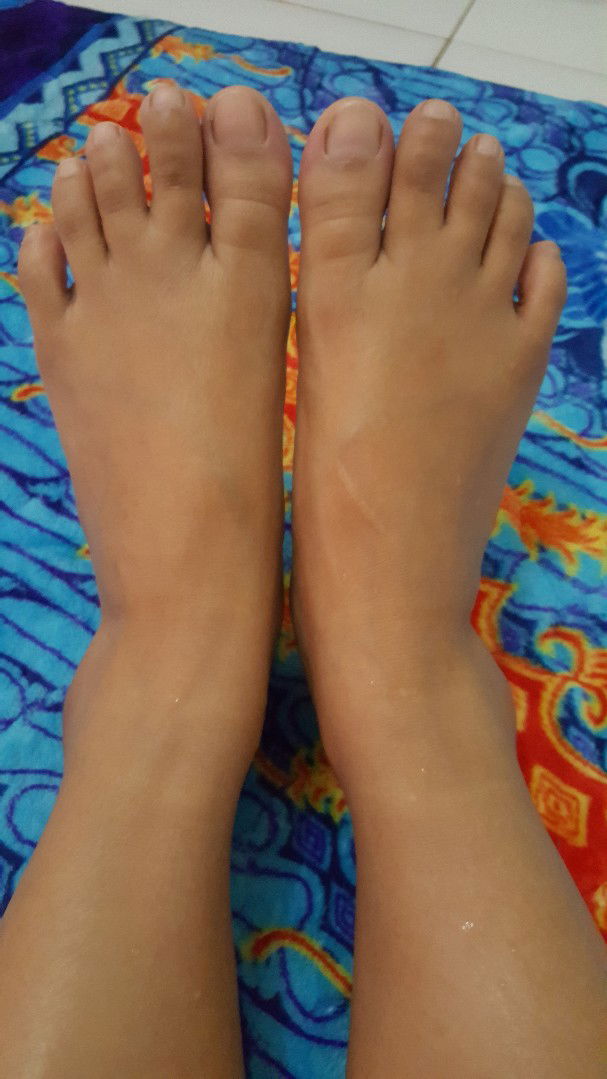 kaki tangan terasa kencang